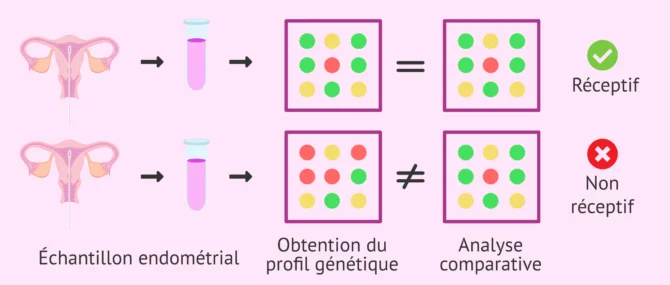 Imagen: Comparaison de l'expression génétique dans le test ERA