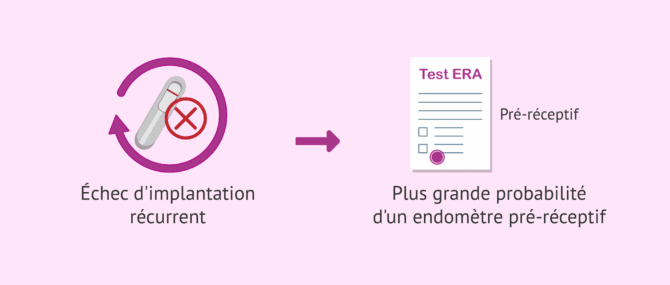 Imagen: Échec d'implantation et réceptivité endométriale