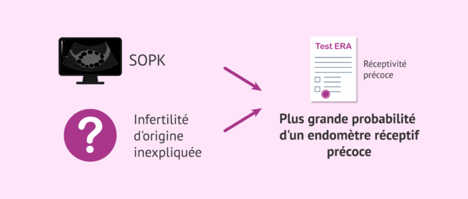 Imagen: SOPK, infertilité inexpliquée et réceptivité endométriale