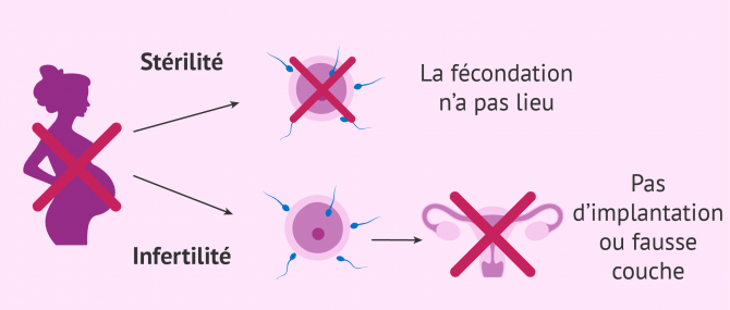 Quelles différences entre stérilité et infertilité?