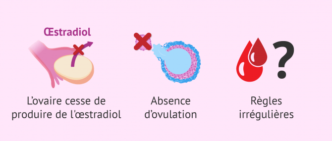 Diagnostic d'insuffisance ovarienne prématurée (IOP)