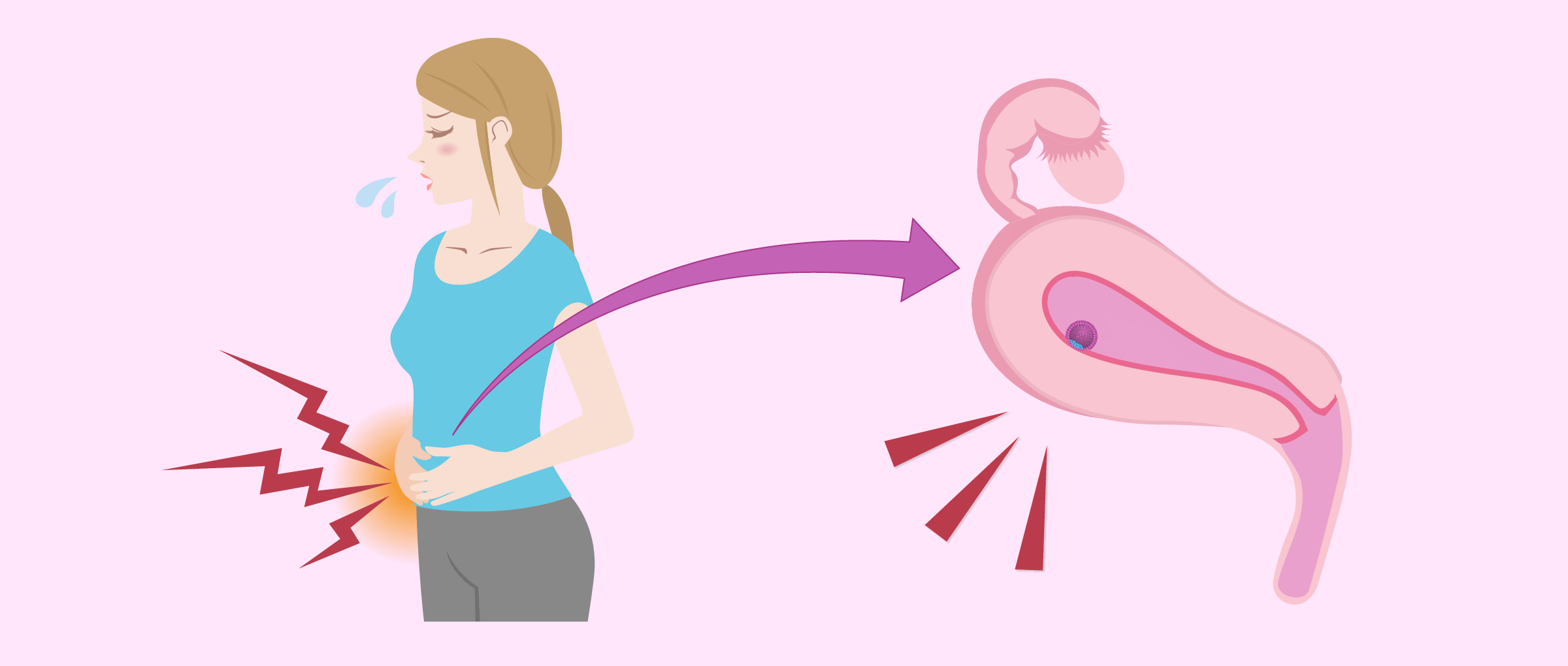 Les crampes pendant la grossesse: comment les soulager?