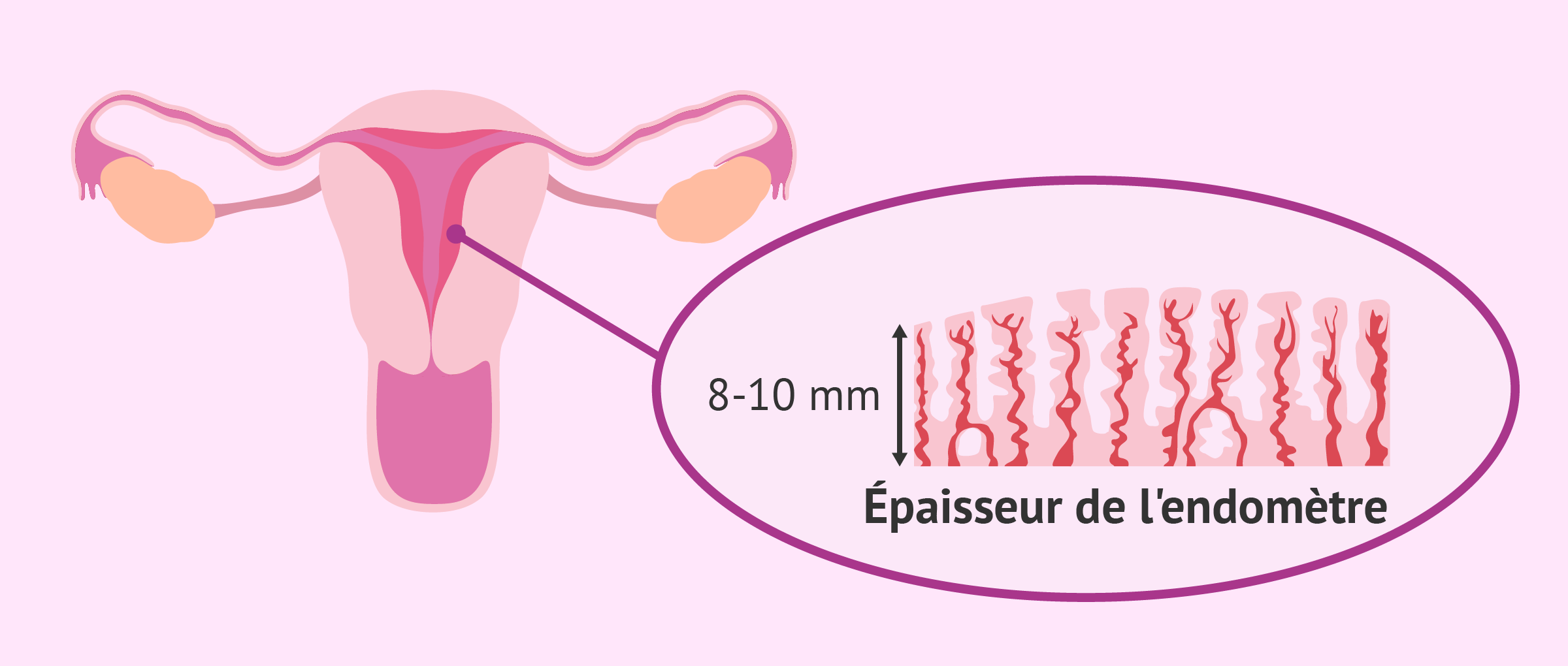 Imagen: épaisseur endomètre pour implantation de l'embryon