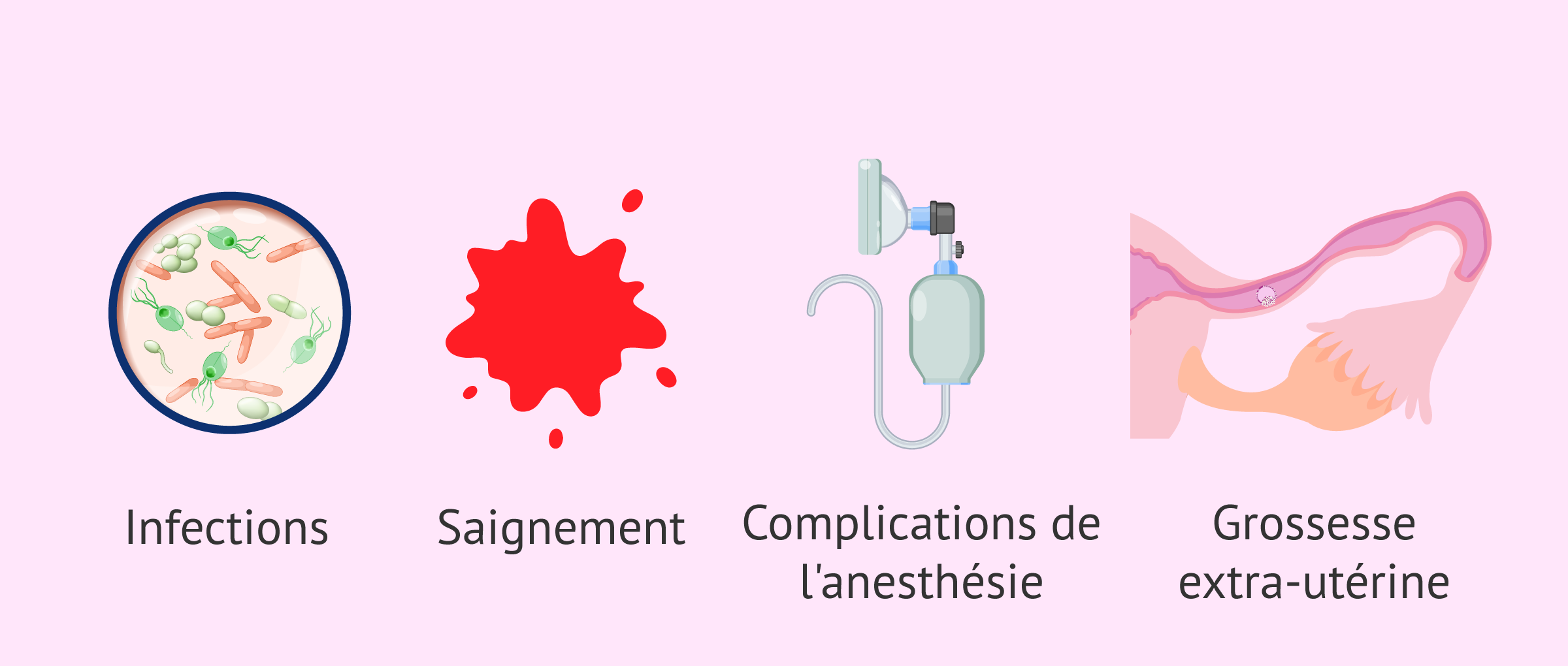 Imagen: Réussir une grossesse après une ligature des trompes