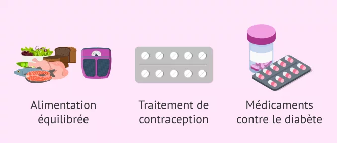 Comment soigner le syndrome d'ovaire polykystique?