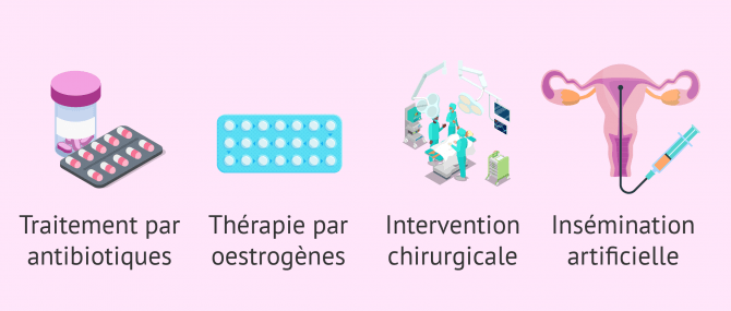 Traitements possibles pour traiter le facteur cervical