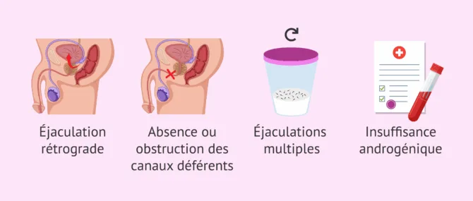 Traitement Ayurvédique Fuites De Sperme – 60 Capsules, à Base De Plantes, Ayush Remedies