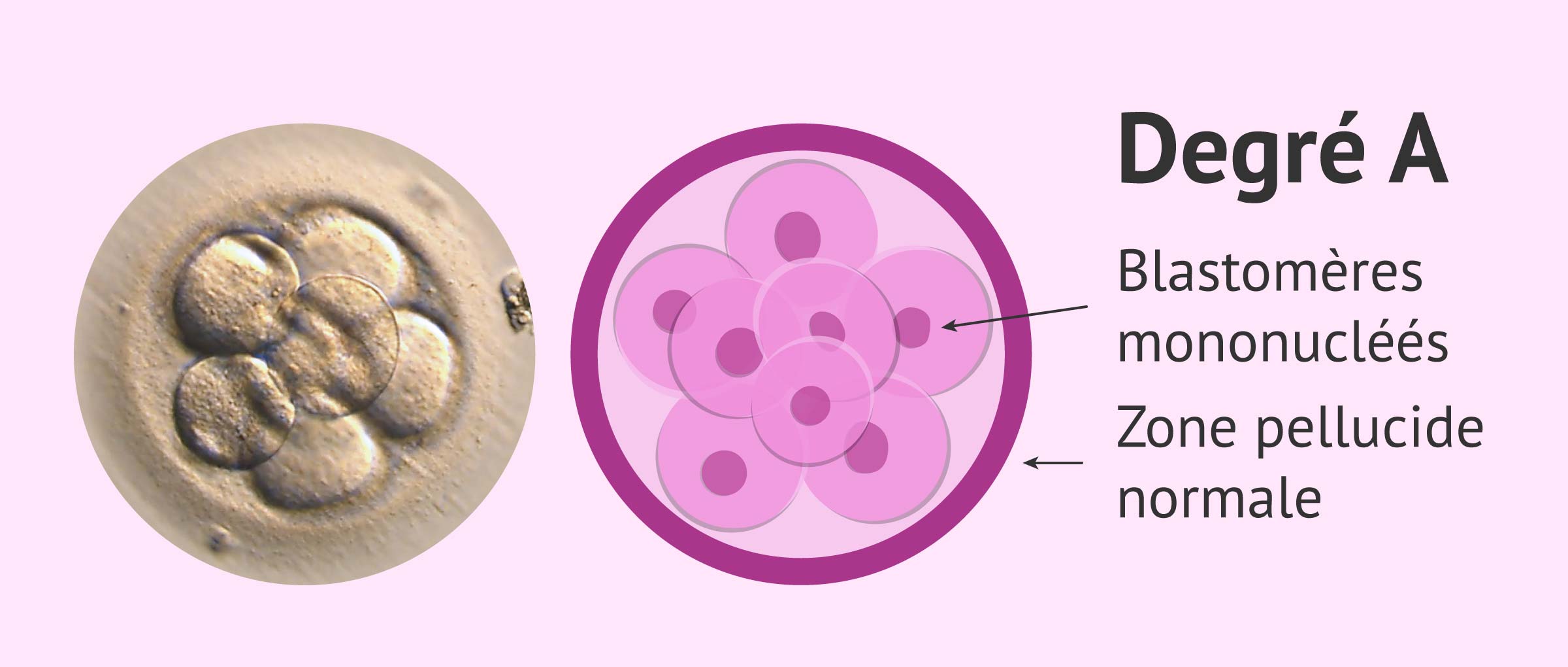 Imagen: Classifier embryons: qualité A