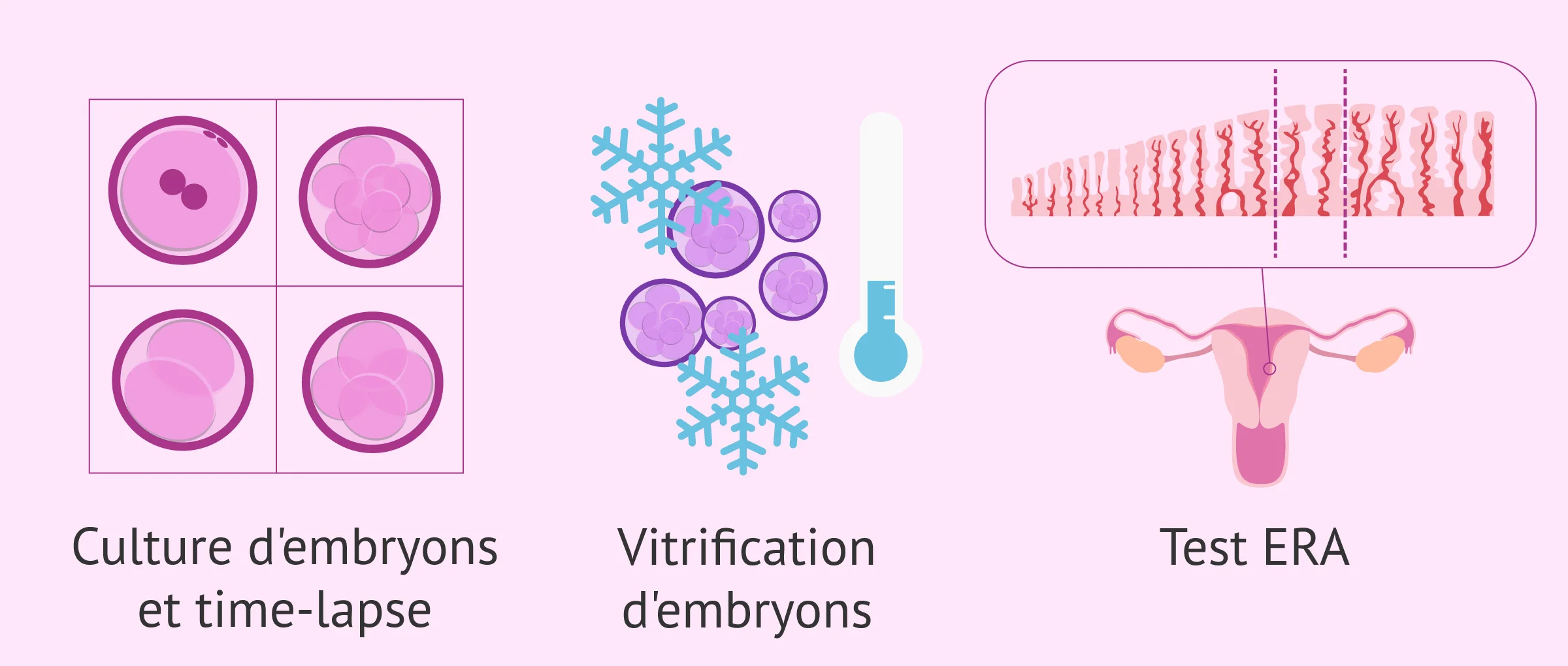 Imagen: Les progrès de la procréation assistée
