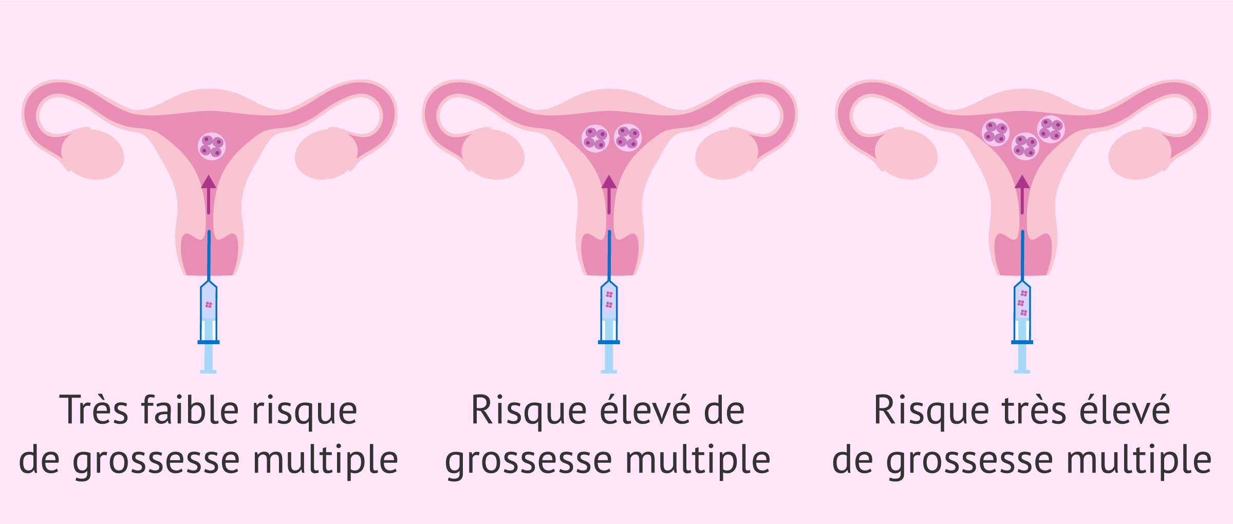 Risque de grossesse multiple en fonction du nombre d'embryons.