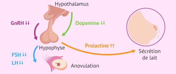 Imagen: En quoi consiste l'hyperprolactinémie?
