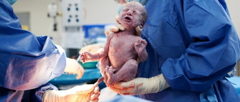 Assistance à l'accouchement