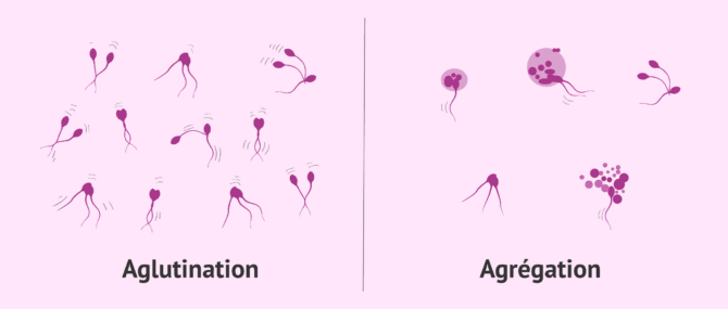 Imagen: Différence entre agglutination spermatique et agrégation