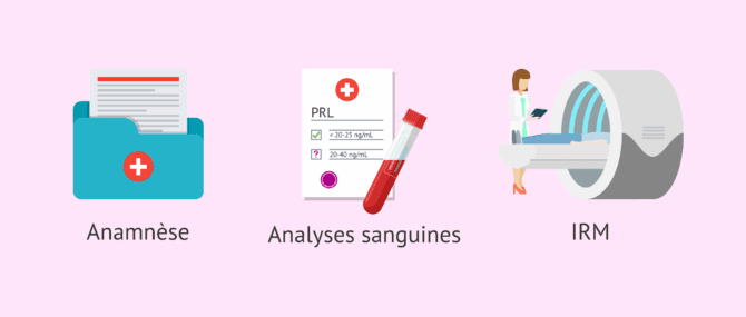 Imagen: Examens diagnostiques de l'hyperprolactinémie