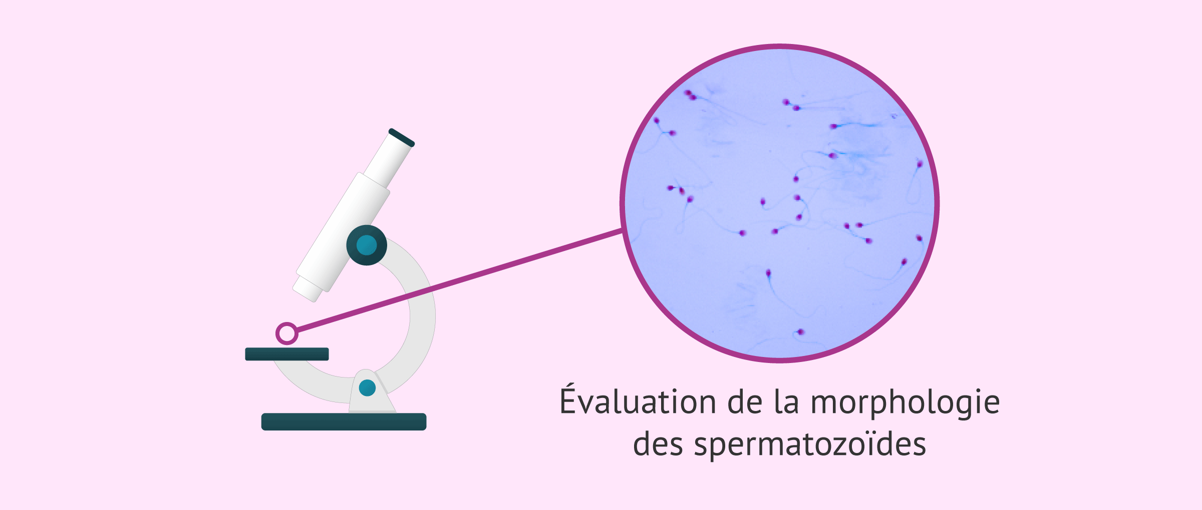 Morphologie spermatique: quelles sont les valeurs normales?