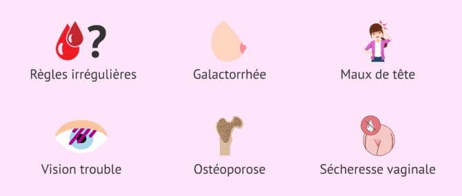 Imagen: Manifestations cliniques de l'hyperprolactinémie