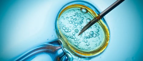 Causes de la grossesse ectopique