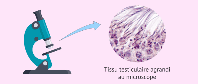 Imagen: Observation du tissu testiculaire au microscope