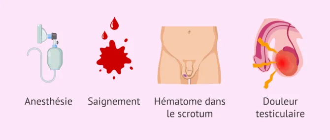 Imagen: Quels sont les risques liés à une biopsie testiculaire?