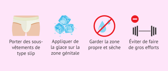 Imagen: Que faire après une biopsie testiculaire?