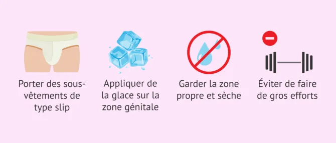 Imagen: Que faire après une biopsie testiculaire?