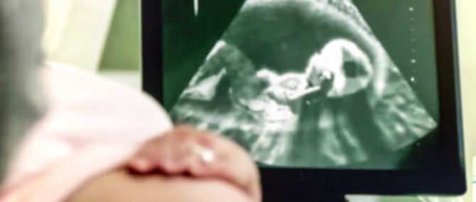 Examens durant le deuxième trimestre