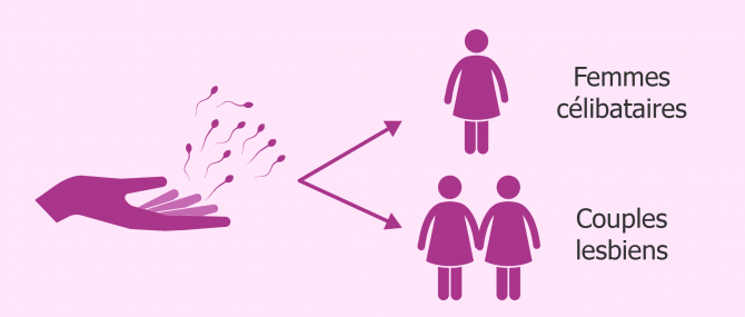 Don de sperme pour femmes sans partenaire masculin