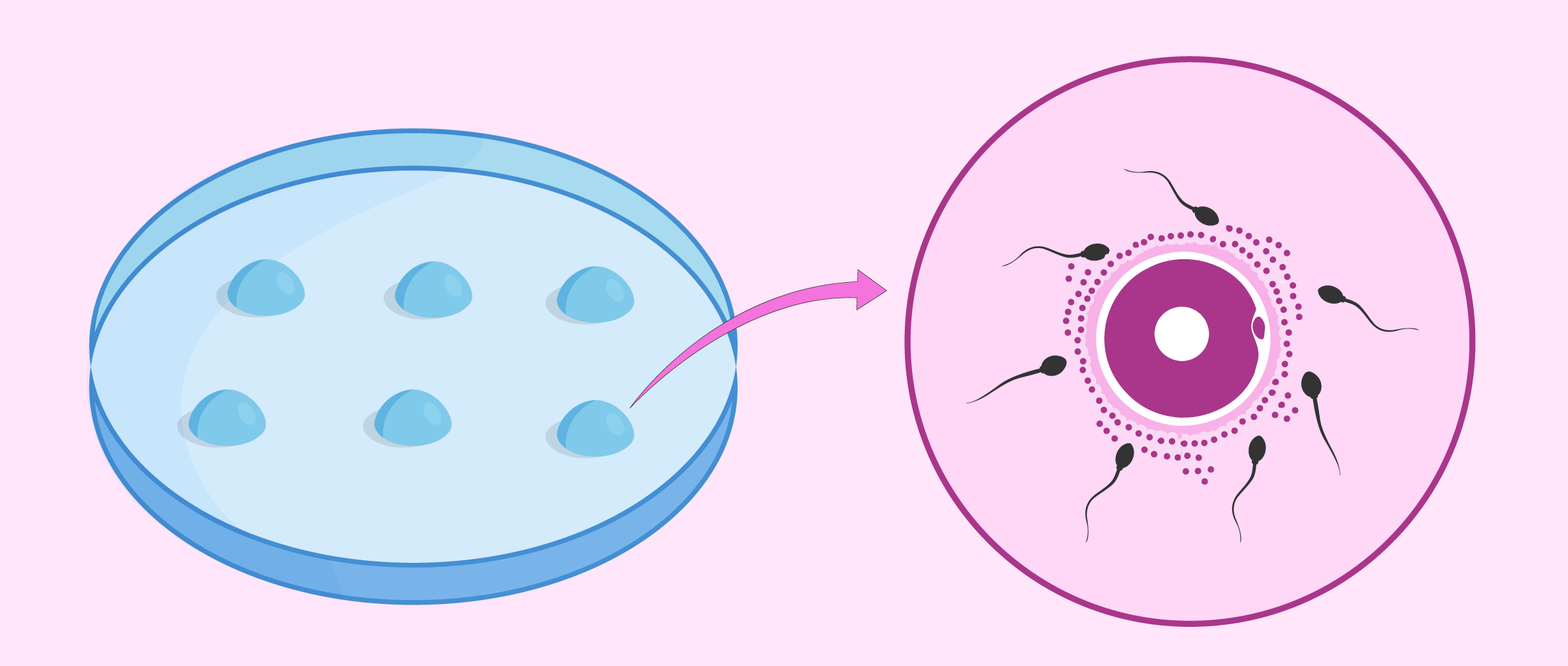 Imagen: Fécondation in vitro classique