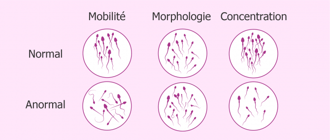Problèmes de mobilité, morphologie ou concentration des spermatozoïdes