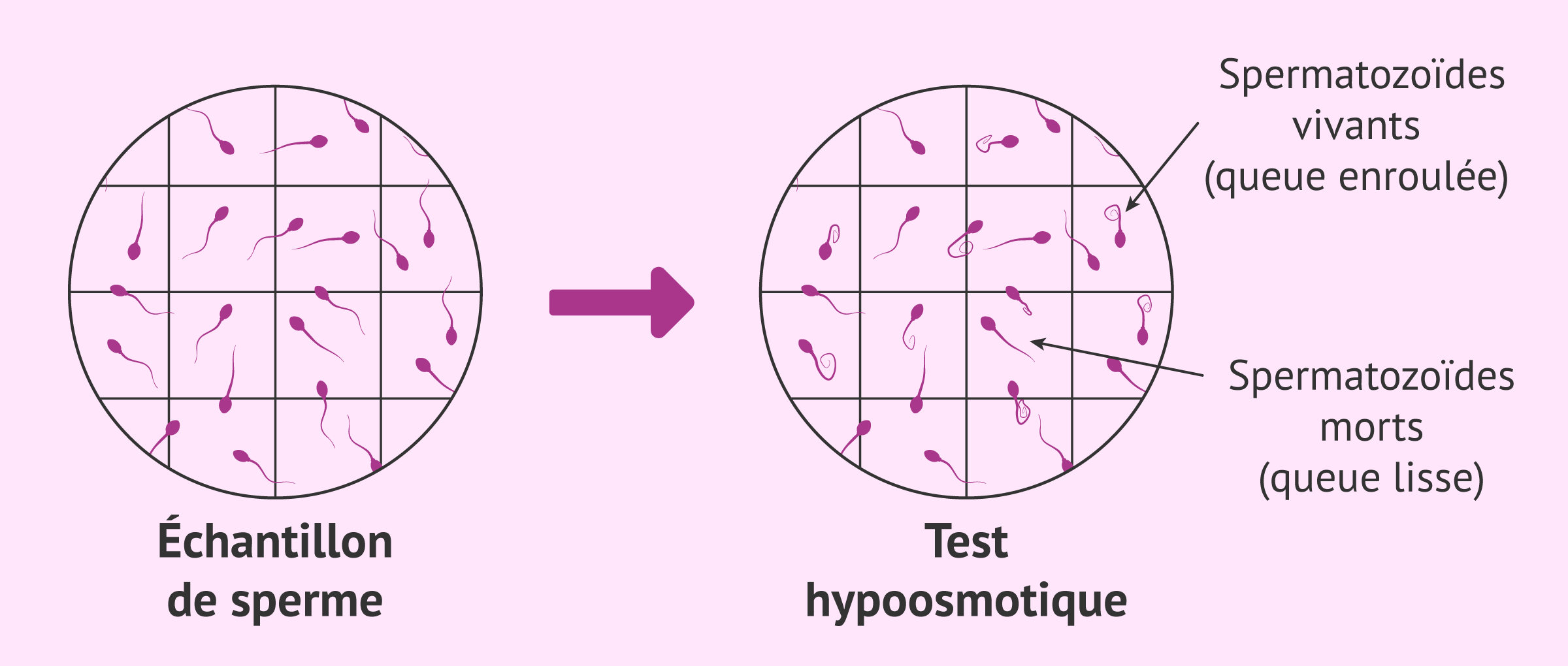 Teste hipoosmótico para diagnóstico de necrospermia