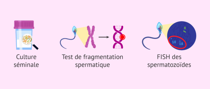 Imagen: Examens complémentaires à un spermogramme