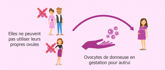 Don d'ovocytes en GPA en cas d'incapacité médicale