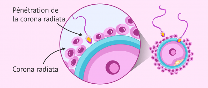 Pénétration de la «corona radiata»