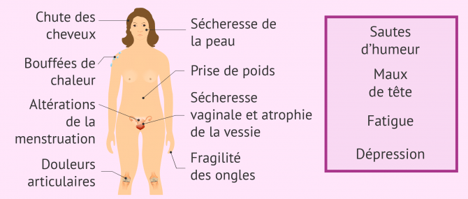 Quand et comment se produit la ménopause? - Symptômes et traitement