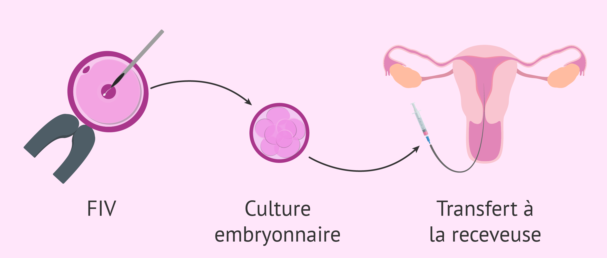 Fécondation in vitro avec ovocytes de donneuse