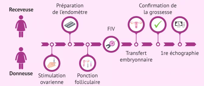 Bénéficier d&rsquo;un don d’ovocytes: procédure à suivre par la receveuse