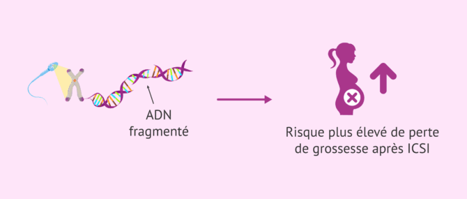 Imagen: Fragmentation de l'ADN spermatique et risque de fausse couche