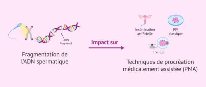 Imagen: Comment la fragmentation de l'ADN spermatique affecte-t-elle la procréation assistée?