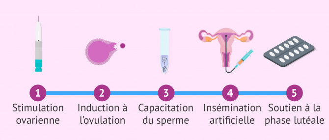 Étapes du traitement d'insémination artificielle (IA)