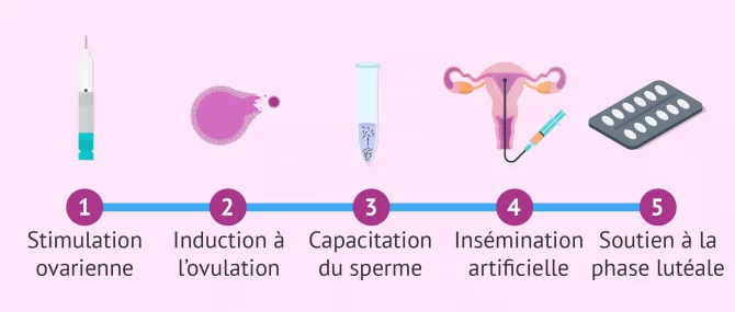 Étapes du traitement d'insémination artificielle (IA)