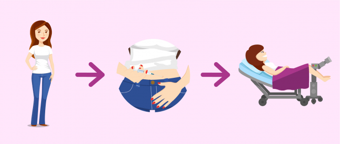 Etapes pour la donneuse d'ovocytes