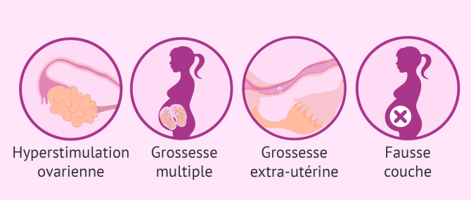 Risques et effets secondaires que comporte l'insémination artificielle