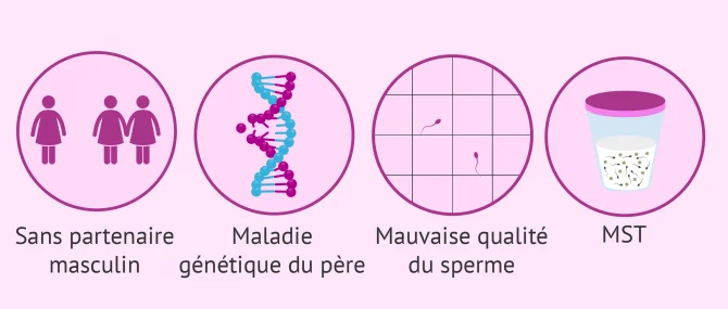 Indications de l'insémination artificielle avec du sperme de donneur