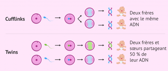 Imagen: Différence entre les jumeaux et les jumelles