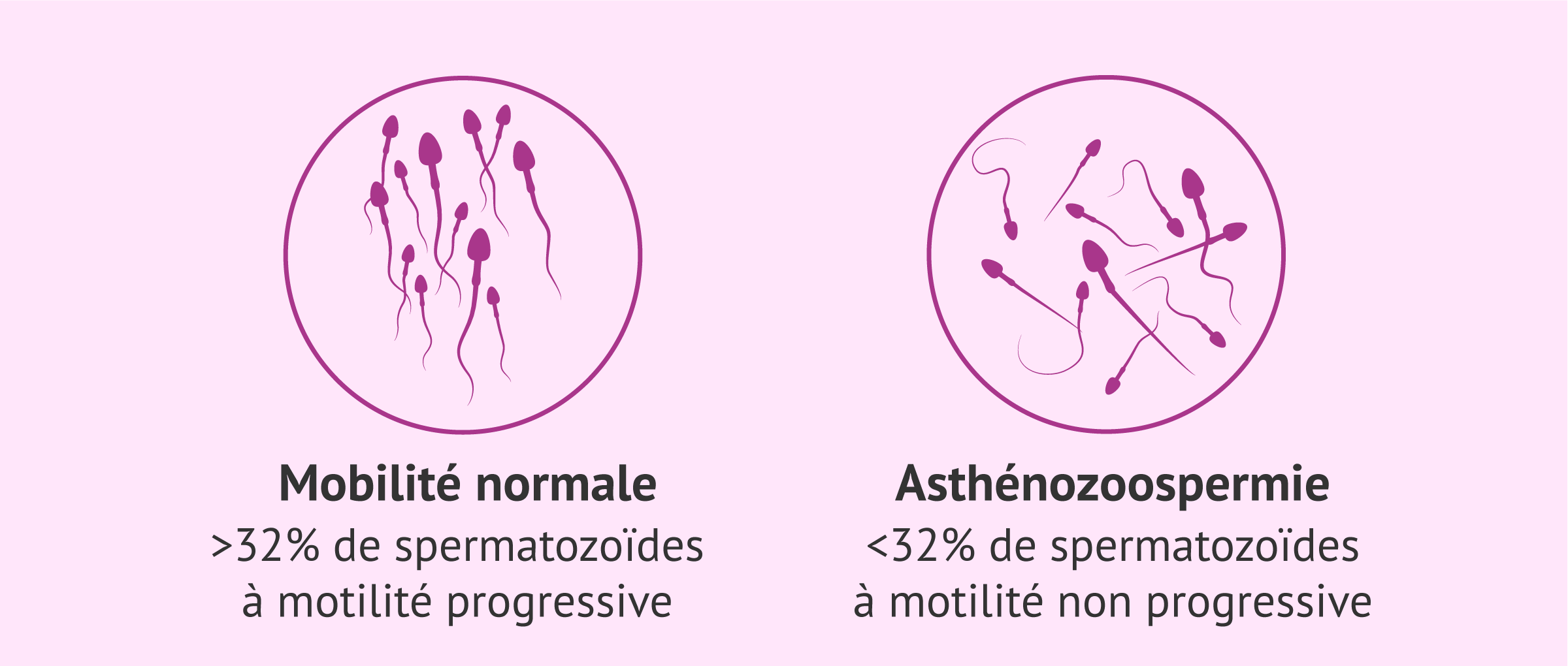 Imagen: ICSI pour les problèmes de mobilité des spermatozoïdes