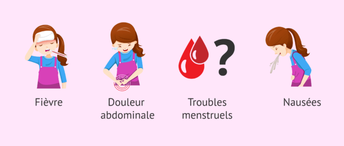 Imagen: Symptômes de l'inflammation de l'ovaire