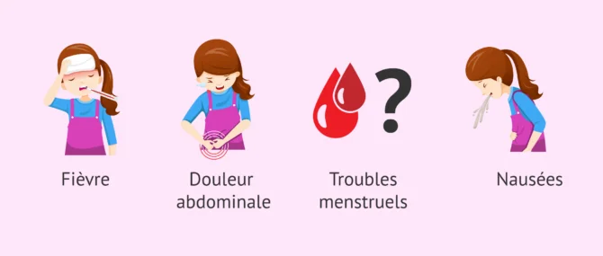 Imagen: Symptômes de l'inflammation de l'ovaire