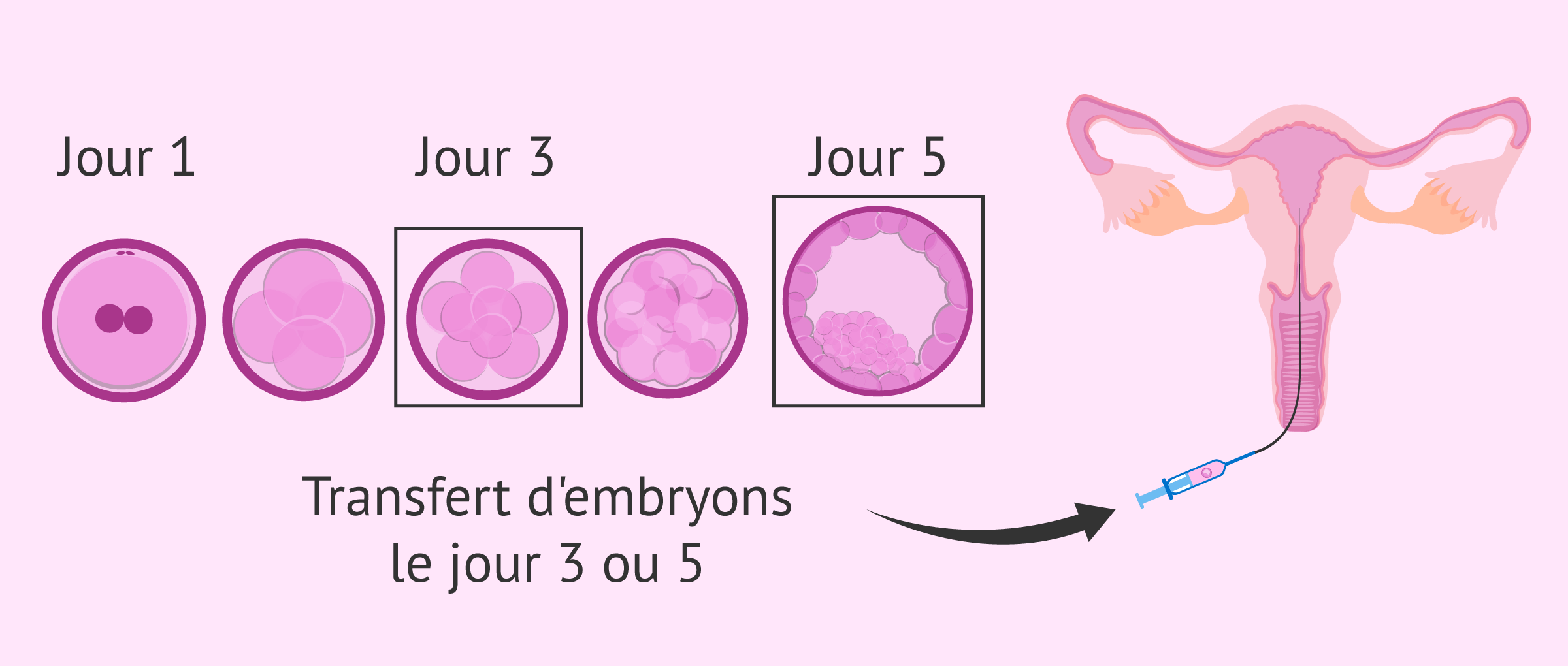 Synthétiser 24+ articles sur le sujet que faire apres un transfert d embryon [récemment mis à Synthétiser 24+ articles sur le sujet que faire apres un transfert d embryon [récemment mis à
