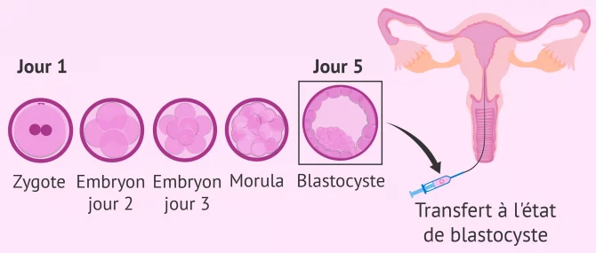 Culture séquentielle pour le transfert embryonnaire