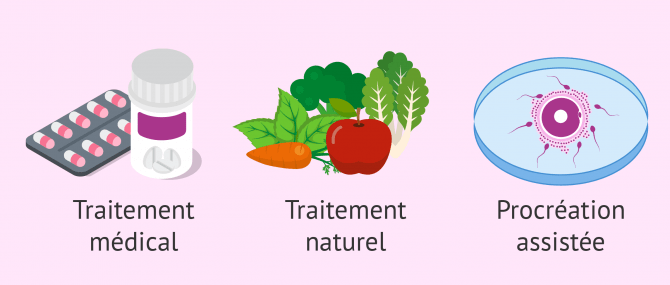 Différents traitements de l'infertilité masculine